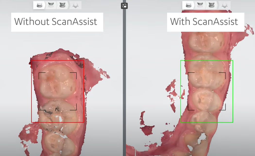 JP_T5 launch_LP ScanAssist.PNG